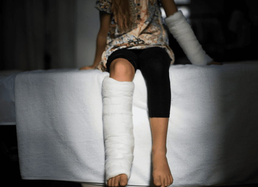 Young Caucasian girl with broken leg in plaster cast suffered personal injury